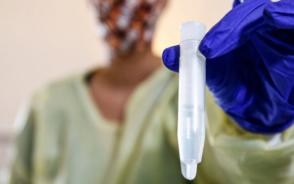 TEST SALIVARE 690x362 0af14