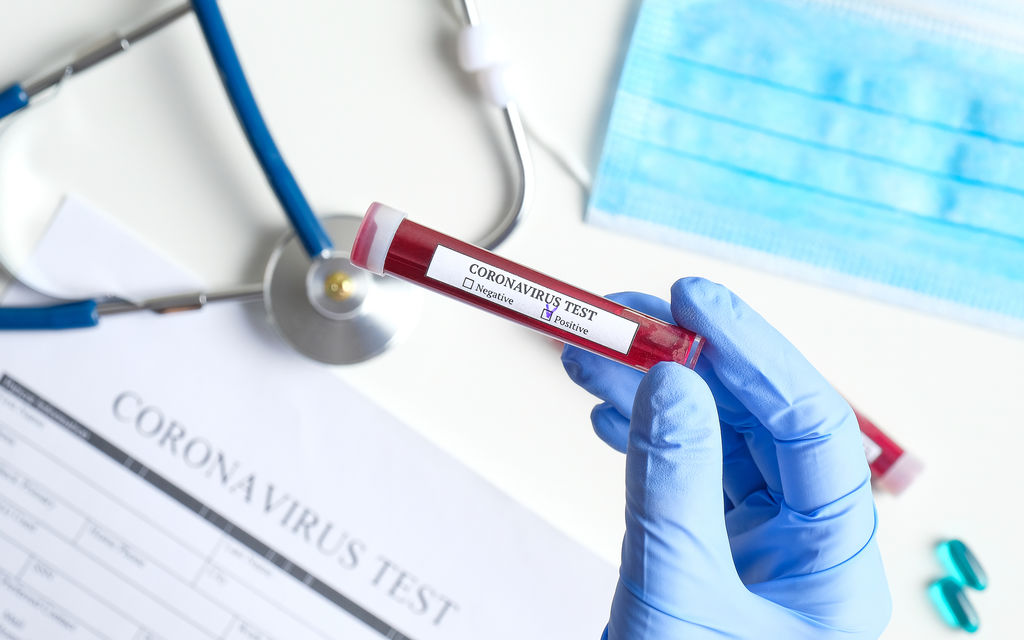 Coronavirus Test 982c7