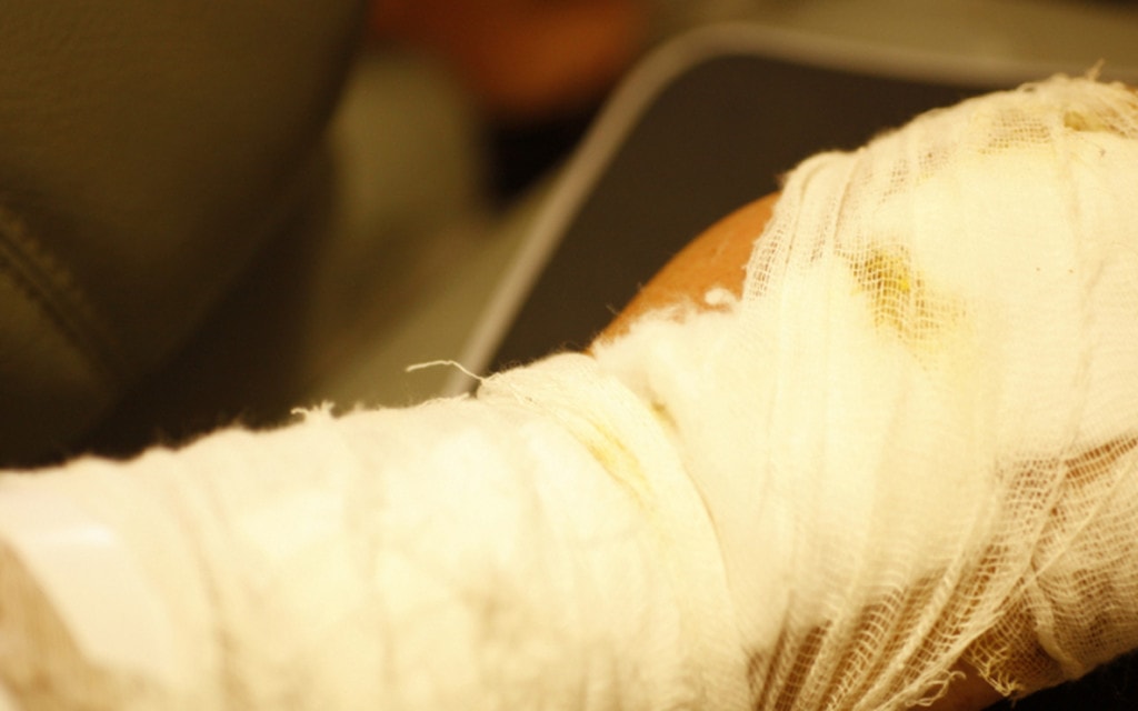 L  Giovane Si Ferisce Con La Fresa Da Neve Gdtf C6a88