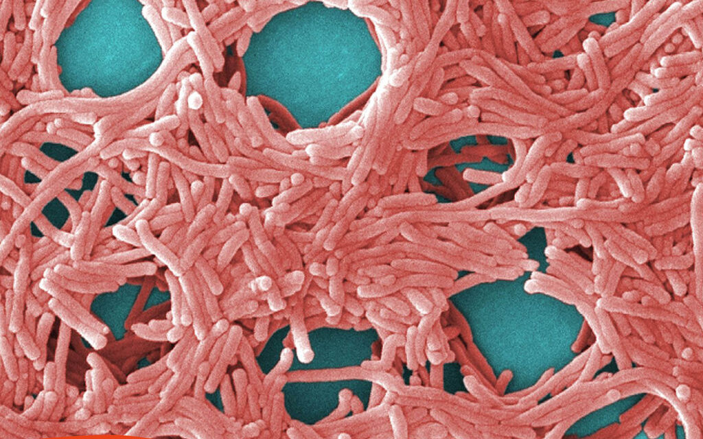 Legionella 9eee7
