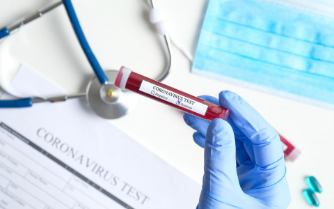 In Svizzera 9702 nuovi casi di coronavirus