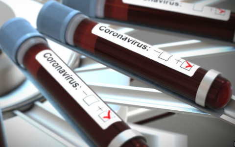 Coronavirus: regole per le manifestazioni